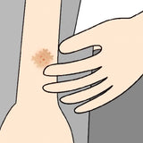 Mosquito Moskinto: After-Bite Patch (42 Ct) - Itch-Relief